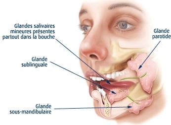 Pathologies des glandes salivaires - orl.nc